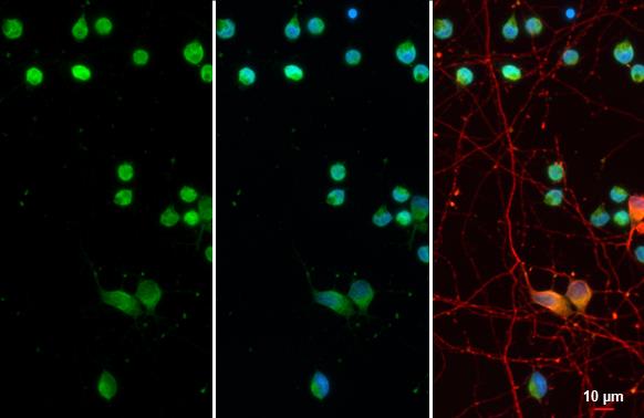 Olig2 antibody detects Olig2 protein at oligodendrocyte by immunofluorescent analysis. Sample: DIV10 rat cortical neuron-no AraC cells were fixed in 4% paraformaldehyde at RT for 15 min. Green: Olig2 stained by Olig2 antibody (GTX636104) diluted at 1:500. Red: Tau, a marker, stained by Tau antibody [GT287] (GTX634809) diluted at 1:500.