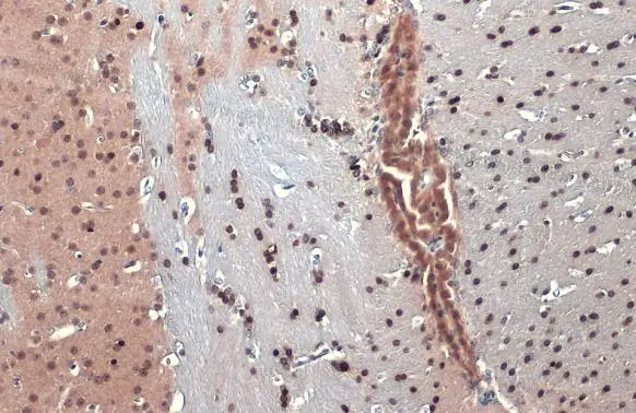 OLIG2 antibody [HL1072]