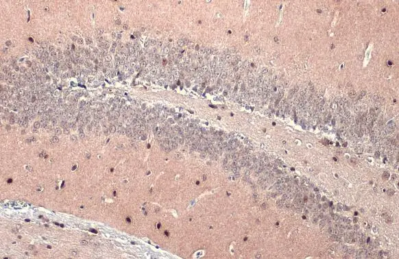 OLIG2 antibody [HL1072] detects OLIG2 protein at nucleus by immunohistochemical analysis. Sample: Paraffin-embedded mouse brain. OLIG2 stained by OLIG2 antibody [HL1072] (GTX636104) diluted at 1:100. Antigen Retrieval: Citrate buffer, pH 6.0, 15 min