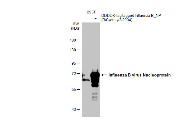 Non-transfected (-) and transfected (+) 293T whole cell extracts (30 microg) were separated by 7.5% SDS-PAGE, and the membrane was blotted with Influenza B virus Nucleoprotein antibody [HL1073] (GTX636194) diluted at 1:5000. The HRP-conjugated anti-rabbit IgG antibody (GTX213110-01) was used to detect the primary antibody.