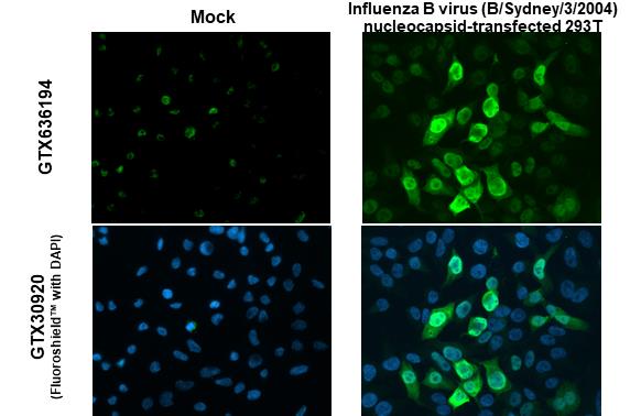 Influenza B virus Nucleoprotein antibody (GTX636194) detects overexpressed Influenza virus Nucleoprotein protein by immunofluorescent analysis. Sample: Mock and transfected 293T cells were fixed in 4% paraformaldehyde at RT for 15 min. Green: Influenza B virus Nucleoprotein stained by Influenza B virus Nucleoprotein antibody (GTX636194) diluted at 1:2000.