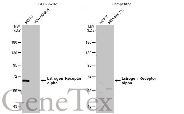 Various whole cell extracts (30 μg) were separated by 7.5% SDS-PAGE, and the membranes were blotted with Estrogen Receptor alpha antibody [HL1081] (GTX636202) diluted at 1:1000 and competitor's antibody (Competitor) diluted at 1:100. The HRP-conjugated anti-rabbit IgG antibody (GTX213110-01) was used to detect the primary antibody, and the signal was developed with Trident ECL plus-Enhanced. *The competitor is not affiliated with GeneTex and does not endorse this product.