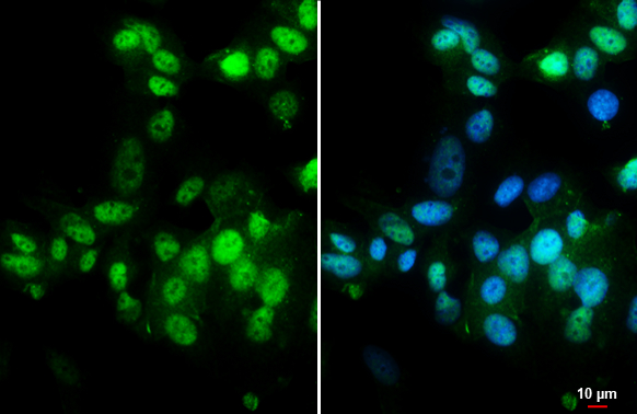 Estrogen Receptor alpha antibody [HL1081] detects Estrogen Receptor alpha protein at nucleus by immunofluorescent analysis. Sample: MCF-7 cells were fixed in 4% paraformaldehyde at RT for 15 min. Green: Estrogen Receptor alpha stained by Estrogen Receptor alpha antibody [HL1081] (GTX636202) diluted at 1:500. Blue: Fluoroshield with DAPI (GTX30920).