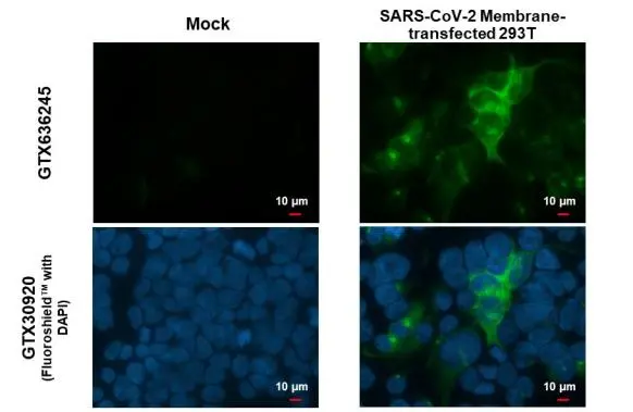 SARS-CoV-2 (COVID-19) Membrane antibody [HL1087] detects SARS-CoV-2 (COVID-19) Membrane protein by immunofluorescent analysis. Sample: 293T cells were fixed in 4% paraformaldehyde at RT for 15 min. Green: SARS-CoV-2 (COVID-19) Membrane stained by SARS-CoV-2 (COVID-19) Membrane antibody [HL1087] (GTX636245) diluted at 1:2000. Blue: Fluoroshield with DAPI (GTX30920).