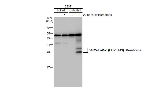 Non-transfected (–) and transfected (+) 293T whole cell extracts (30 μg) were separated by 12% SDS-PAGE, and the membrane was blotted with SARS-CoV-2 (COVID-19) Membrane antibody [HL1088] (GTX636246) diluted at 1:20000. The HRP-conjugated anti-rabbit IgG antibody (GTX213110-01) was used to detect the primary antibody.