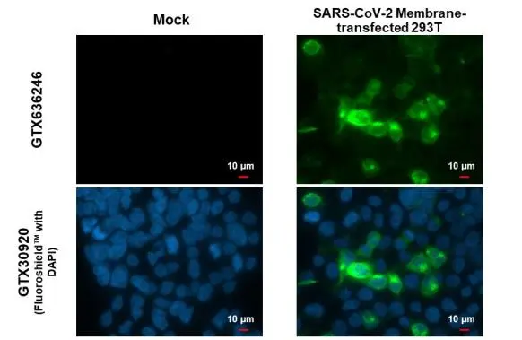 SARS-CoV-2 (COVID-19) Membrane antibody [HL1088] detects SARS-CoV-2 (COVID-19) Membrane protein by immunofluorescent analysis. Sample: 293T cells were fixed in 4% paraformaldehyde at RT for 15 min. Green: SARS-CoV-2 (COVID-19) Membrane stained by SARS-CoV-2 (COVID-19) Membrane antibody [HL1088] (GTX636246) diluted at 1:2000. Blue: Fluoroshield with DAPI (GTX30920).