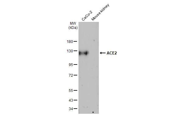 Various whole cell and tissue extracts were separated by 7.5% SDS-PAGE, and the membrane was blotted with ACE2 antibody [HL1092] (GTX636265) diluted at 1:1000. The HRP-conjugated anti-rabbit IgG antibody (GTX213110-01) was used to detect the primary antibody, and the signal was developed with Trident femto Western HRP Substrate.