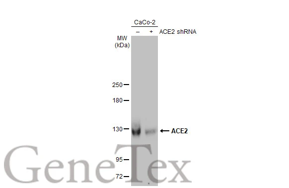 大人気新作 Anti-ACE2 GeneTex | (GTX636265) [HL1092] antibody バッグ
