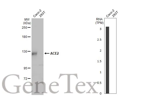 本物品質の Anti-ACE2 antibody [HL1092] (GTX636265) | GeneTex バッグ