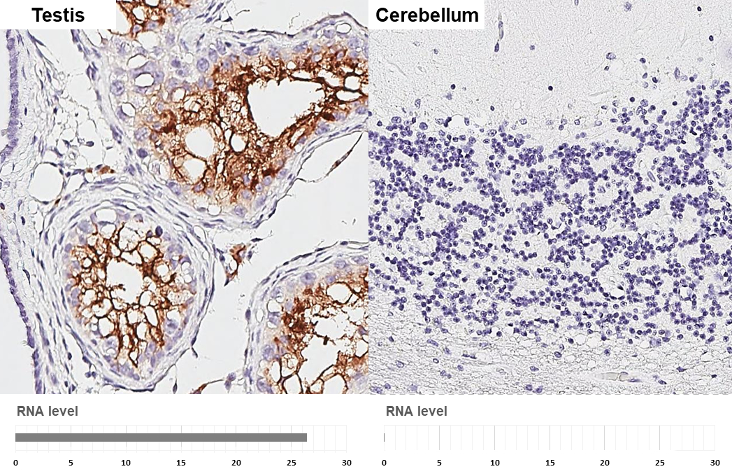 ACE2 antibody [HL1092] detects ACE2 protein by immunohistochemical analysis. Sample: Paraffin-embedded human tissues. ACE2 stained by ACE2 antibody [HL1092] (GTX636265) diluted at 1:10000. Antigen Retrieval: Tris-EDTA buffer, pH 9.0, 15 min