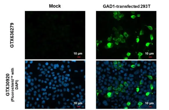 GAD67 antibody [HL1095]
