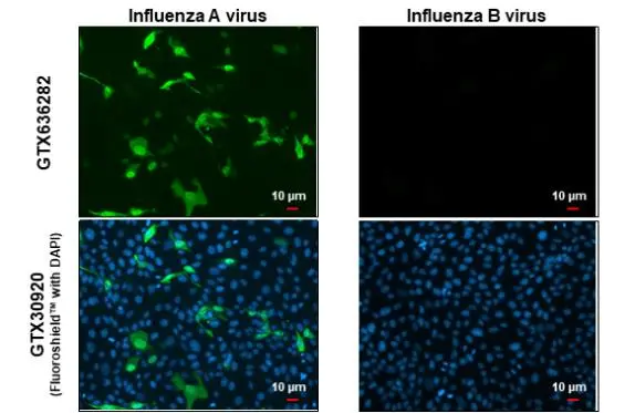 Immunofluorescent analysis of influenza virus infected cells using Influenza A virus Nucleoprotein antibody (GTX636282). Sample: Influenza A and B Virus infected cells slide. Green: Influenza A virus Nucleoprotein antibody (GTX636282) diluted at 1:100.