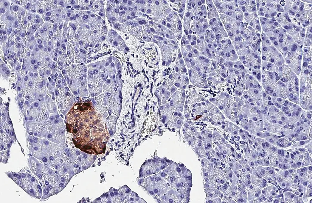 Anti-Somatostatin antibody [HL1101] (GTX636297) | GeneTex