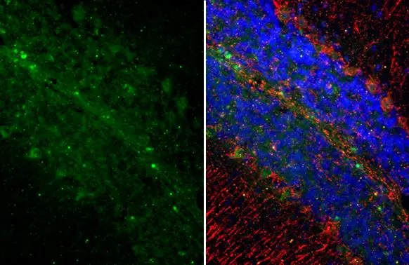 Somatostatin antibody [HL1101] detects Somatostatin protein at cytoplasm by immunohistochemical analysis. Sample: Paraffin-embedded mouse brain. Green: Somatostatin stained by Somatostatin antibody [HL1101] (GTX636297) diluted at 1:250. Red: NF-H, a neural marker, stained by NF-H antibody [GT114] (GTX634289) diluted at 1:250. Blue: Fluoroshield with DAPI (GTX30920). Antigen Retrieval: Citrate buffer, pH 6.0, 15 min