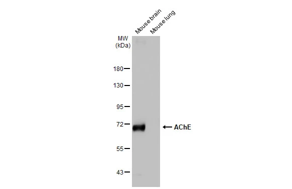 Various tissue extracts (50 μg) were separated by 7.5% SDS-PAGE, and the membrane was blotted with AChE antibody [HL1102] (GTX636298) diluted at 1:1000. The HRP-conjugated anti-rabbit IgG antibody (GTX213110-01) was used to detect the primary antibody.