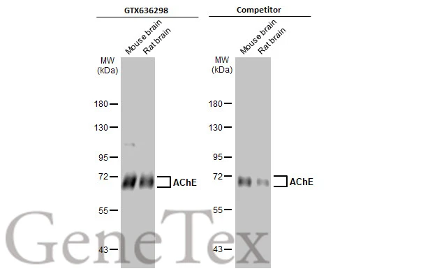 Various tissue extracts (50 microg) were separated by 7.5% SDS-PAGE, and the membranes were blotted with AChE antibody [HL1102] (GTX636298) diluted at 1:1000 and competitors antibody (competitor) diluted at 1:1000. The HRP-conjugated anti-rabbit IgG antibody (GTX213110-01) was used to detect the primary antibody. *The competitor is not affiliated with GeneTex and does not endorse this product.