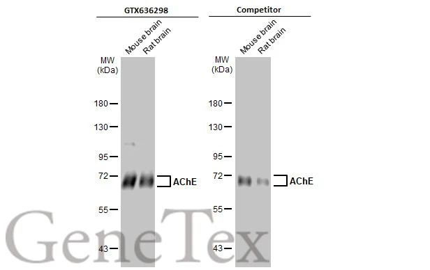 Various tissue extracts (50 μg) were separated by 7.5% SDS-PAGE, and the membranes were blotted with AChE antibody [HL1102] (GTX636298) diluted at 1:1000 and competitor's antibody (competitor) diluted at 1:1000. The HRP-conjugated anti-rabbit IgG antibody (GTX213110-01) was used to detect the primary antibody. *The competitor is not affiliated with GeneTex and does not endorse this product.
