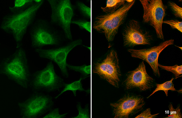 AChE antibody [HL1102] detects AChE protein at endoplasmic reticulum by immunofluorescent analysis. Sample: HeLa cells were fixed in 4% paraformaldehyde at RT for 15 min. Green: AChE stained by AChE antibody [HL1102] (GTX636298) diluted at 1:500. Red: alpha Tubulin, a cytoskeleton marker, stained by alpha Tubulin antibody [GT114] (GTX628802) diluted at 1:1000. Blue: Fluoroshield with DAPI (GTX30920). Scale bar= 10μm.