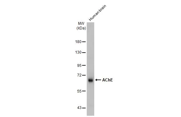 Human tissue extract (30 μg) was separated by 7.5% SDS-PAGE, and the membrane was blotted with AChE antibody [HL1102] (GTX636298) diluted at 1:500. The HRP-conjugated anti-rabbit IgG antibody (GTX213110-01) was used to detect the primary antibody, and the signal was developed with Trident ECL plus-Enhanced.
