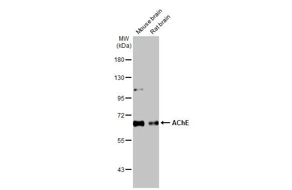 Anti-AChE antibody [HL1102] (GTX636298) | GeneTex