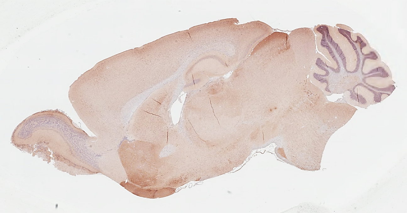 AChE antibody [HL1102] detects AChE protein by immunohistochemical analysis. Sample: Paraffin-embedded mouse brain. AChE stained by AChE antibody [HL1102] (GTX636298) diluted at 1:1000. Antigen Retrieval: Citrate buffer, pH 6.0, 15 min