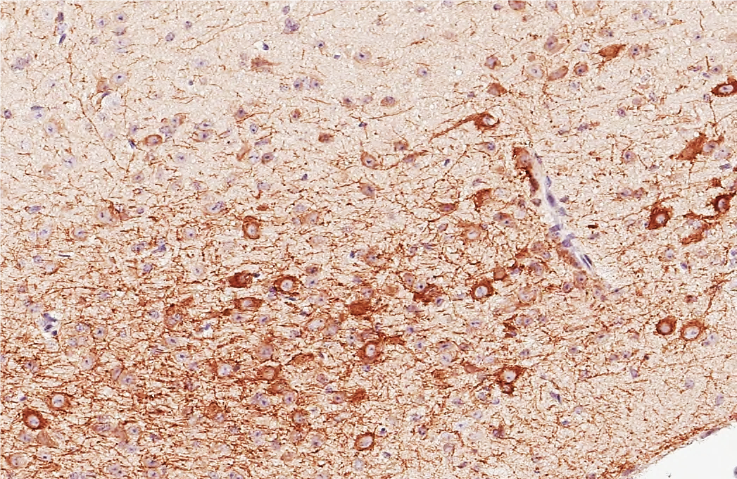AChE antibody [HL1102] detects AChE protein by immunohistochemical analysis. Sample: Paraffin-embedded mouse basal forebrain. AChE stained by AChE antibody [HL1102] (GTX636298) diluted at 1:1000. Antigen Retrieval: Citrate buffer, pH 6.0, 15 min