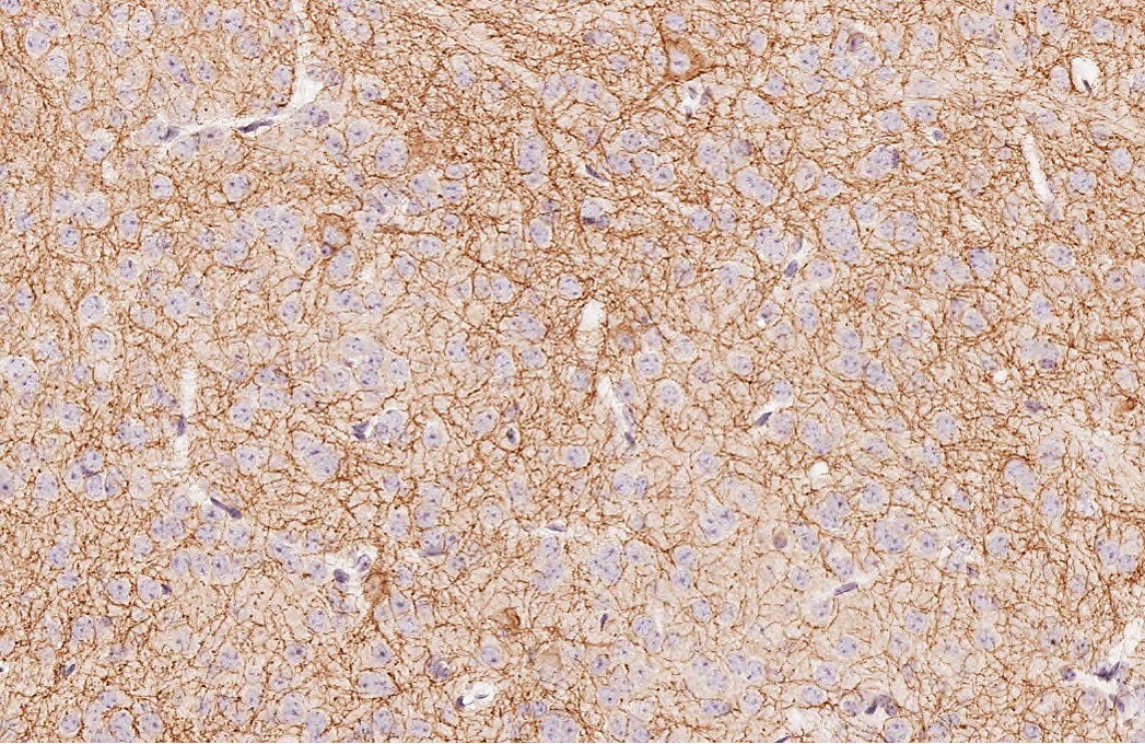 AChE antibody [HL1102] detects AChE protein by immunohistochemical analysis. Sample: Paraffin-embedded mouse nucleus accumbens. AChE stained by AChE antibody [HL1102] (GTX636298) diluted at 1:1000. Antigen Retrieval: Citrate buffer, pH 6.0, 15 min