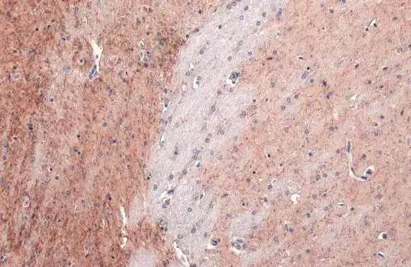 AChE antibody [HL1102] detects AChE protein at cell membrane and cytoplasm by immunohistochemical analysis. Sample: Paraffin-embedded mouse brain. AChE stained by AChE antibody [HL1102] (GTX636298) diluted at 1:100. Antigen Retrieval: Citrate buffer, pH 6.0, 15 min