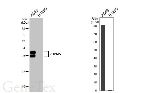 Various whole cell extracts were separated by 12% SDS-PAGE, and the membrane was blotted with RBPMS antibody [HL1106] (GTX636321) diluted at 1:5000. The HRP-conjugated anti-rabbit IgG antibody (GTX213110-01) was used to detect the primary antibody. Corresponding RNA expression data are based on Human Protein Atlas program.