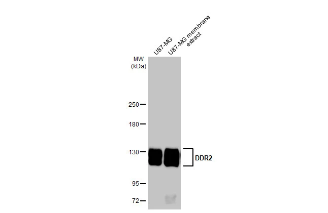 U87-MG whole cell and membrane extracts (30 microg) were separated by 5% SDS-PAGE, and the membrane was blotted with DDR2 antibody [HL1107] (GTX636322) diluted at 1:1000. The HRP-conjugated anti-rabbit IgG antibody (GTX213110-01) was used to detect the primary antibody.