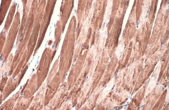 DDR2 antibody [HL1107]