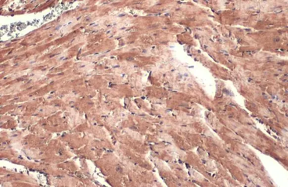 DDR2 antibody [HL1107]