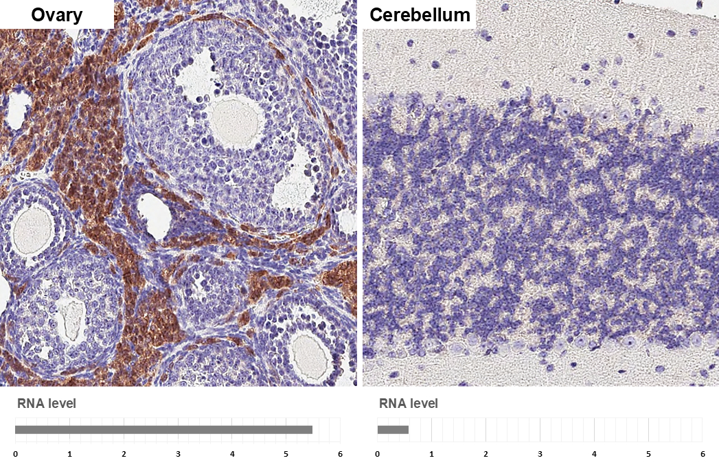 DDR2 antibody [HL1107] detects DDR2 protein by immunohistochemical analysis. Sample: Paraffin-embedded mouse tissues. DDR2 stained by DDR2 antibody [HL1107] (GTX636322) diluted at 1:16000. Antigen Retrieval: Tris-EDTA buffer, pH 9.0, 15 min