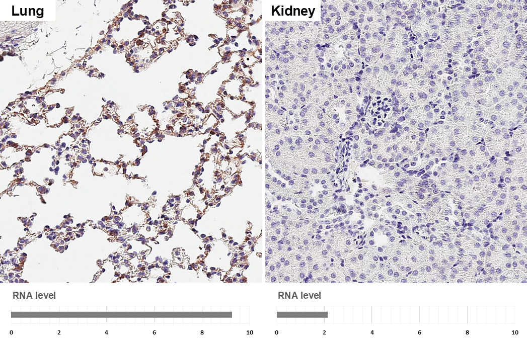 DDR2 antibody [HL1107] detects DDR2 protein by immunohistochemical analysis. Sample: Paraffin-embedded mouse tissues. DDR2 stained by DDR2 antibody [HL1107] (GTX636322) diluted at 1:16000. Antigen Retrieval: Tris-EDTA buffer, pH 9.0, 15 min