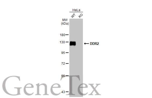 Various whole cell extracts (30 μg) were separated by 7.5% SDS-PAGE, and the membrane was blotted with DDR2 antibody [HL1107] (GTX636322) diluted at 1:1000. The HRP-conjugated anti-rabbit IgG antibody (GTX213110-01) was used to detect the primary antibody.