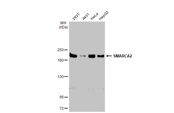 SMARCA2 antibody [HL1114]