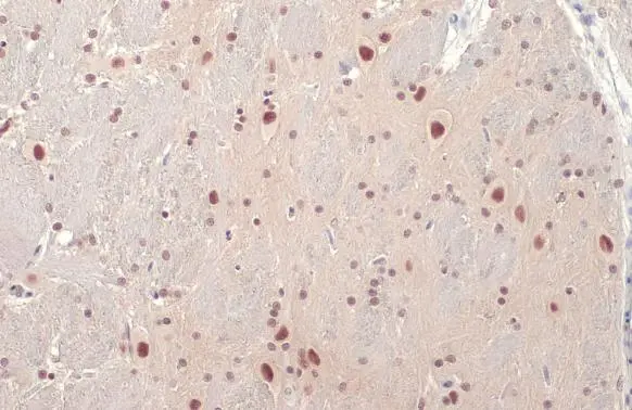 SMARCA2 antibody [HL1114] detects SMARCA2 protein at nucleus by immunohistochemical analysis. Sample: Paraffin-embedded rat brain. SMARCA2 stained by SMARCA2 antibody [HL1114] (GTX636329) diluted at 1:100. Antigen Retrieval: Citrate buffer, pH 6.0, 15 min