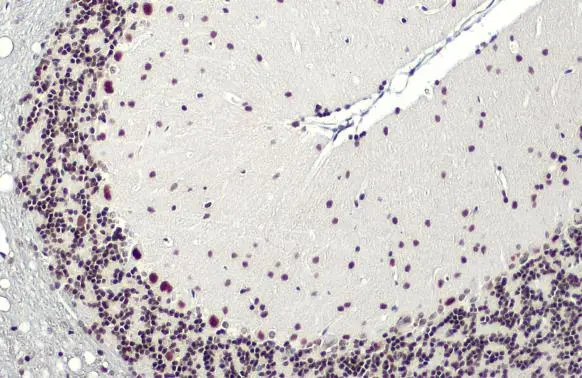 SMARCA2 antibody [HL1115]