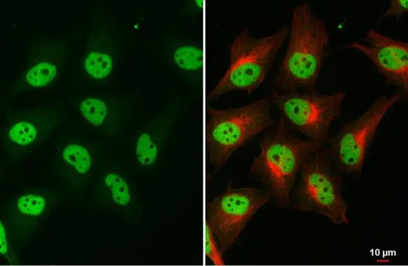SMARCA2 antibody [HL1115]