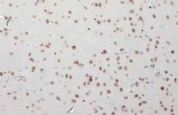 SMARCA2 antibody [HL1115]