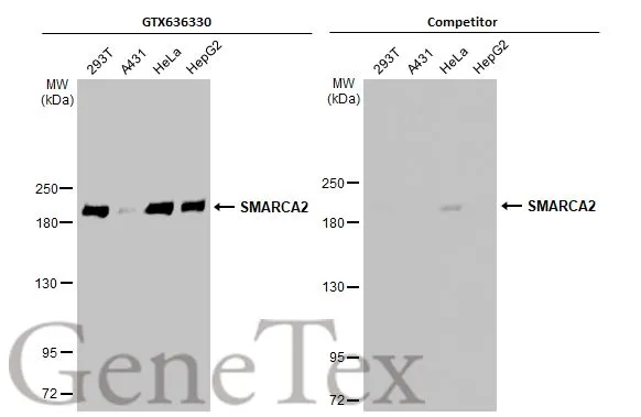 SMARCA2 antibody [HL1115]