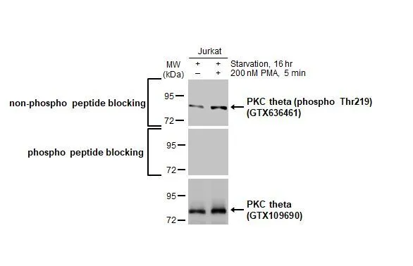 Untreated (–) and treated (+) Jurkat whole cell extracts (30 μg) were separated by 7.5% SDS-PAGE, and the membrane was blotted with PKC theta (phospho Thr219) antibody [HL1157] (GTX636461) diluted at 1:500. The HRP-conjugated anti-rabbit IgG antibody (GTX213110-01) was used to detect the primary antibody.