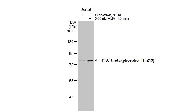 Untreated (–) and treated (+) Jurkat whole cell extracts (30 μg) were separated by 7.5% SDS-PAGE, and the membrane was blotted with PKC theta (phospho Thr219) antibody [HL1157] (GTX636461) diluted at 1:1000. The HRP-conjugated anti-rabbit IgG antibody (GTX213110-01) was used to detect the primary antibody.