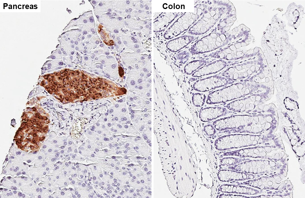 C-Peptide antibody [HL1158] detects C-Peptide protein by immunohistochemical analysis. Sample: Paraffin-embedded mouse tissues. C-Peptide stained by C-Peptide antibody [HL1158] (GTX636462) diluted at 1:1000. Antigen Retrieval: Citrate buffer, pH 6.0, 15 min