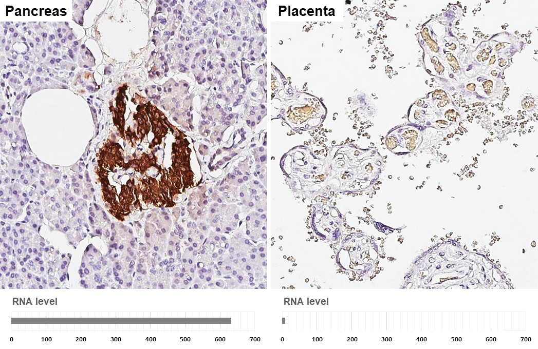 C-Peptide antibody [HL1158] detects C-Peptide protein by immunohistochemical analysis. Sample: Paraffin-embedded human tissues. C-Peptide stained by C-Peptide antibody [HL1158] (GTX636462) diluted at 1:5000. Antigen Retrieval: Citrate buffer, pH 6.0, 15 min