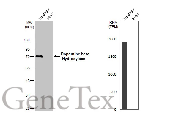 Various whole cell extracts (30 μg) were separated by 10% SDS-PAGE, and the membrane was blotted with Dopamine beta Hydroxylase antibody [HL1163] (GTX636467) diluted at 1:1000. The HRP-conjugated anti-rabbit IgG antibody (GTX213110-01) was used to detect the primary antibody, and the signal was developed with Trident ECL plus-Enhanced. Corresponding RNA expression data for the same cell lines are based on Human Protein Atlas program.