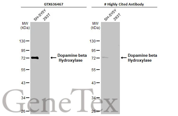 Various whole cell extracts (30 μg) were separated by 10% SDS-PAGE, and the membranes were blotted with Dopamine beta Hydroxylase antibody [HL1163] (GTX636467) diluted at 1:1000 and competitor's antibody (# Highly Cited Antibody) diluted at 1:200. The HRP-conjugated anti-rabbit IgG antibody (GTX213110-01) was used to detect the primary antibody, and the signal was developed with Trident ECL plus-Enhanced. *The competitor is not affiliated with GeneTex and does not endorse this product.