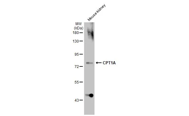 Mouse tissue extract (50 μg) was separated by 7.5% SDS-PAGE, and the membrane was blotted with CPT1A antibody [HL1164] (GTX636468) diluted at 1:1000. The HRP-conjugated anti-rabbit IgG antibody (GTX213110-01) was used to detect the primary antibody.