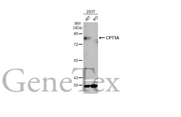 Wild-type (WT) and CPT1A knockout (KO) 293T cell extracts (30 μg) were separated by 7.5% SDS-PAGE, and the membrane was blotted with CPT1A antibody [HL1164] (GTX636468) diluted at 1:1000. The HRP-conjugated anti-rabbit IgG antibody (GTX213110-01) was used to detect the primary antibody, and the signal was developed with Trident ECL plus-Enhanced.