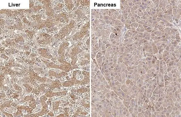 CPT1A antibody [HL1164] detects CPT1A protein at mitochondria by immunohistochemical analysis. Sample: Paraffin-embedded cat tissues. CPT1A stained by CPT1A antibody [HL1164] (GTX636468) diluted at 1:100. Antigen Retrieval: Citrate buffer, pH 6.0, 15 min